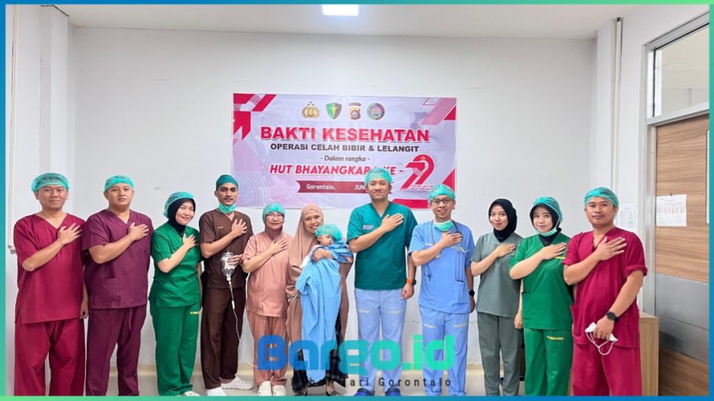 Peringati Hari Bhayangkara ke-79, Polda Gorontalo Gelar Operasi Bibir Sumbing Gratis untuk 21 Anak