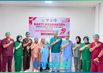 Peringati Hari Bhayangkara ke-79, Polda Gorontalo Gelar Operasi Bibir Sumbing Gratis untuk 21 Anak