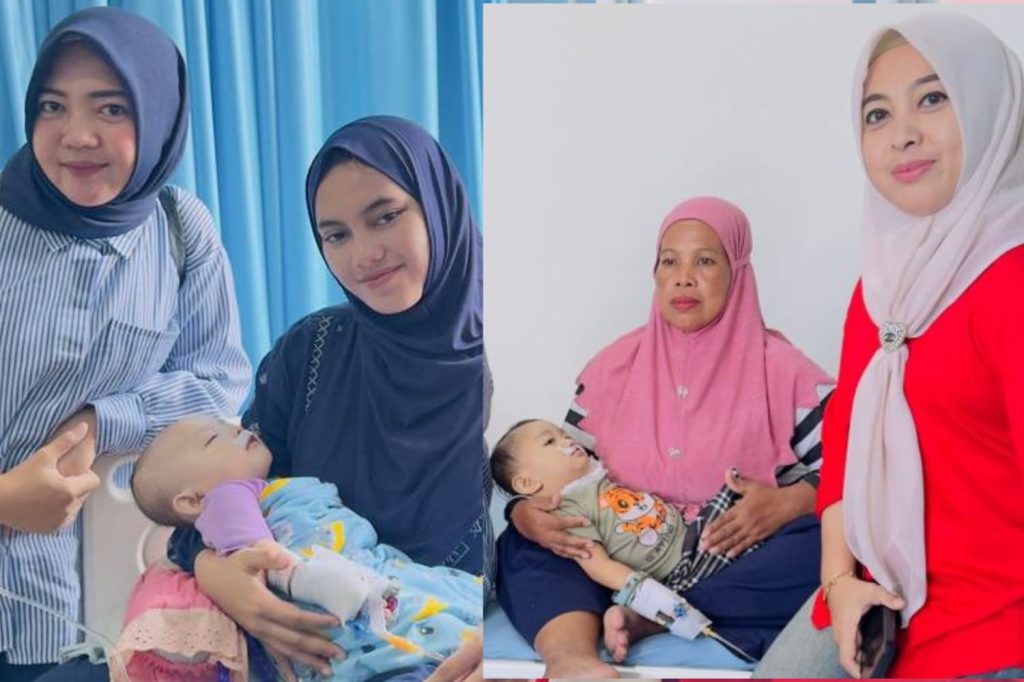 Dua Bayi asal Pohuwato Sukses Operasi Celah Bibir di Makassar