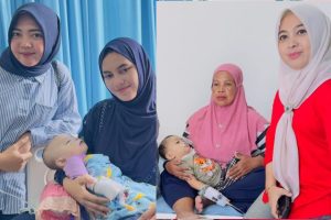 Dua Bayi asal Pohuwato Sukses Operasi Celah Bibir di Makassar