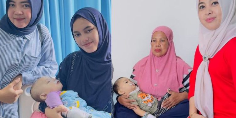 Dua Bayi asal Pohuwato Sukses Operasi Celah Bibir di Makassar